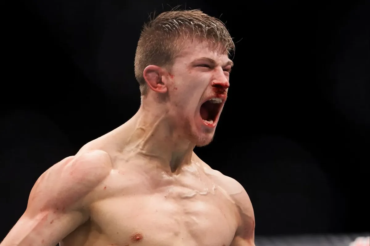 Brit z UFC ukázal potlučenou tvář. Zmlátili mě na ulici, tvrdil