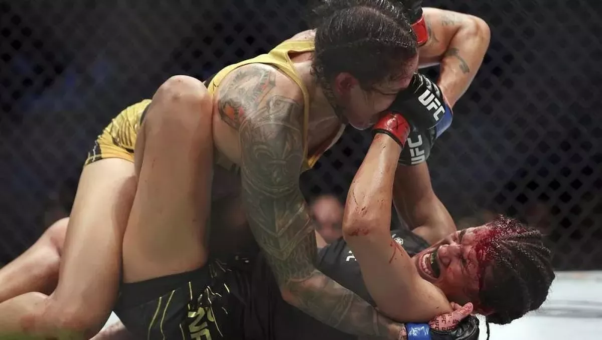 Hororové zranění! Bývalá šampionka UFC přišla o kus čela