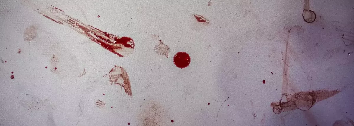 MMA zápasník mohl vyhrát kontumačně po nepovoleném zásahu kolenem do hlavy, soupeře se však rozhodl potrestat jinak