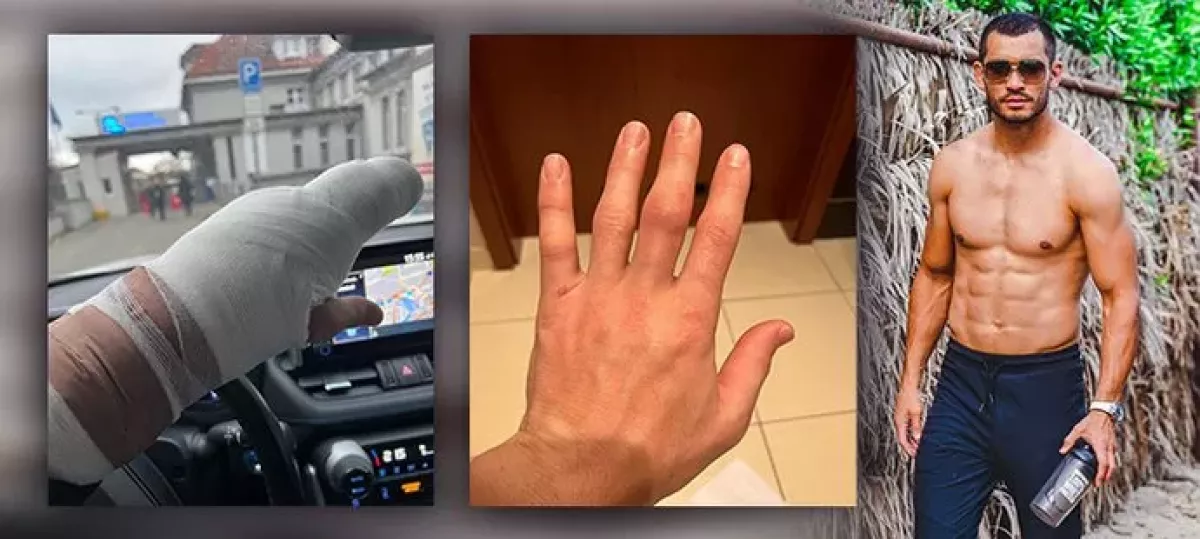 Muradov si zranil prst, bitva se ruší! Popsal jednání s UFC, doufá v březen