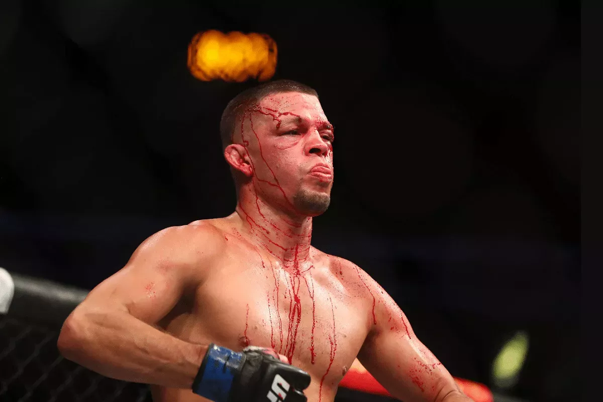 Slavný fighter knokautoval boxera. Hrozí mu až osm let vězení