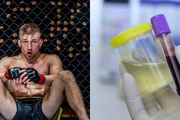 David Kozma prozradil, jak u kolegů pozná, že užívají zakázané látky