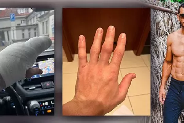 Muradov si zranil prst, bitva se ruší! Popsal jednání s UFC, doufá v březen