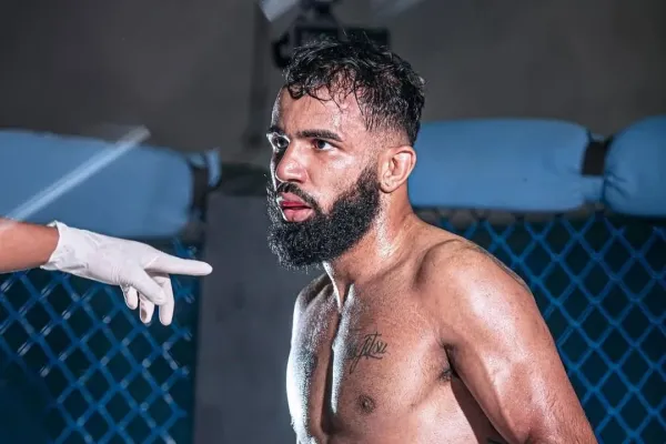 Nic pro slabší povahy. Brazilcova zlomenina vyděsila fanoušky