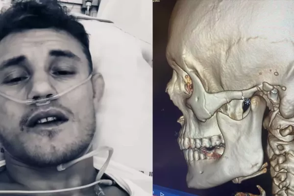 Žralok Jonas Magard posílá omluvný vzkaz z nemocnice a nabízí důkaz